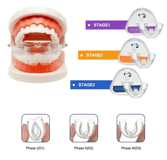 Invisible Braces Orgnic Bloom